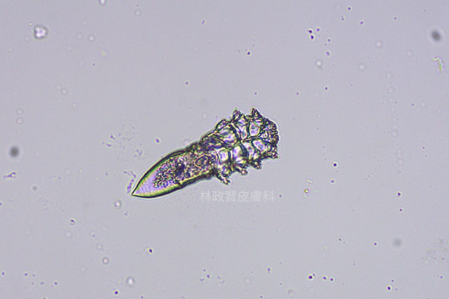 brevis,demodex,demodicosis,毛囊蠕形蟲症,顯微鏡